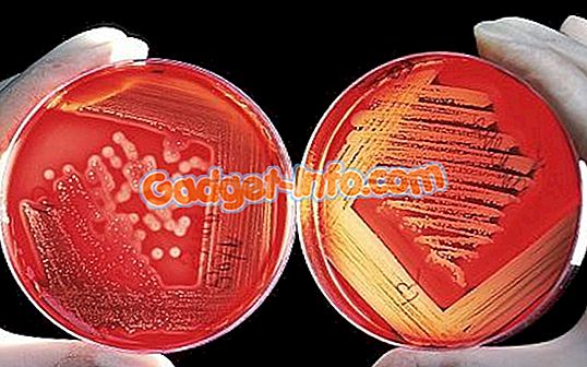 Diferença entre Staphylococcus e Streptococcus